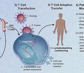 CAR T-cell therapy process illustration.