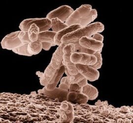 E. coli bacteria under a microscope.