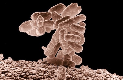 e coli